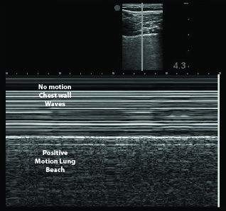 Figure 6 (top)