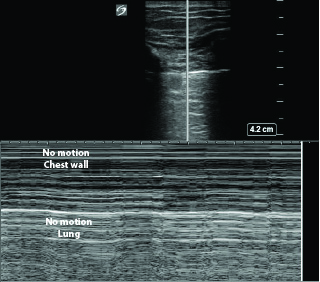 Figure 6 (bottom)