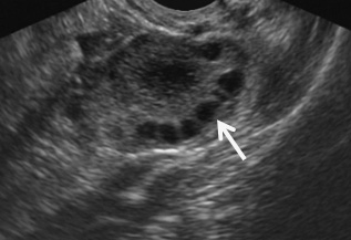 Figure 3a