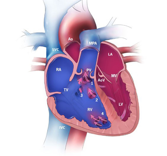 Figure 2