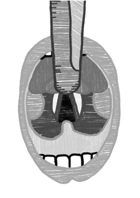 Figure 3_Miller Mouth View