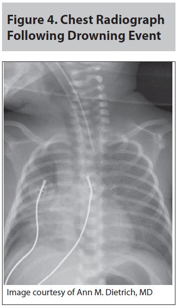 Trauma_figure_4