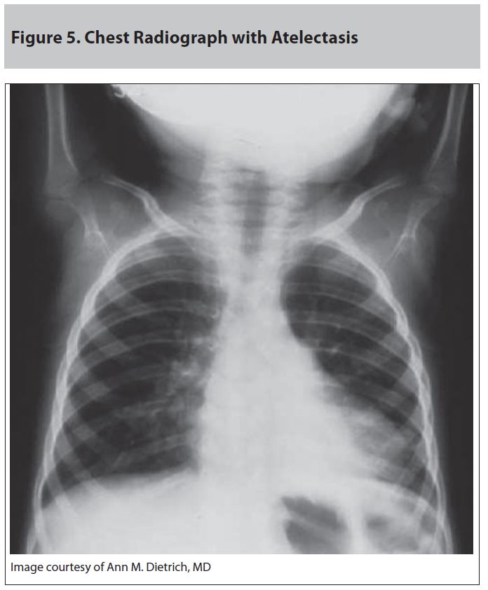 Trauma_figure_5.JPG