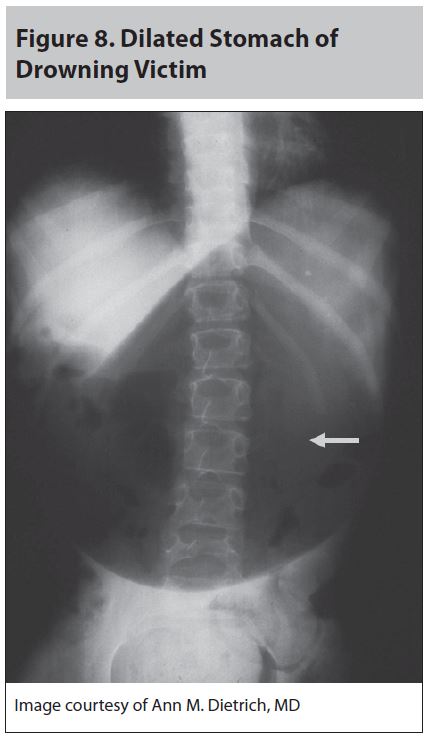 Trauma_figure_8.JPG