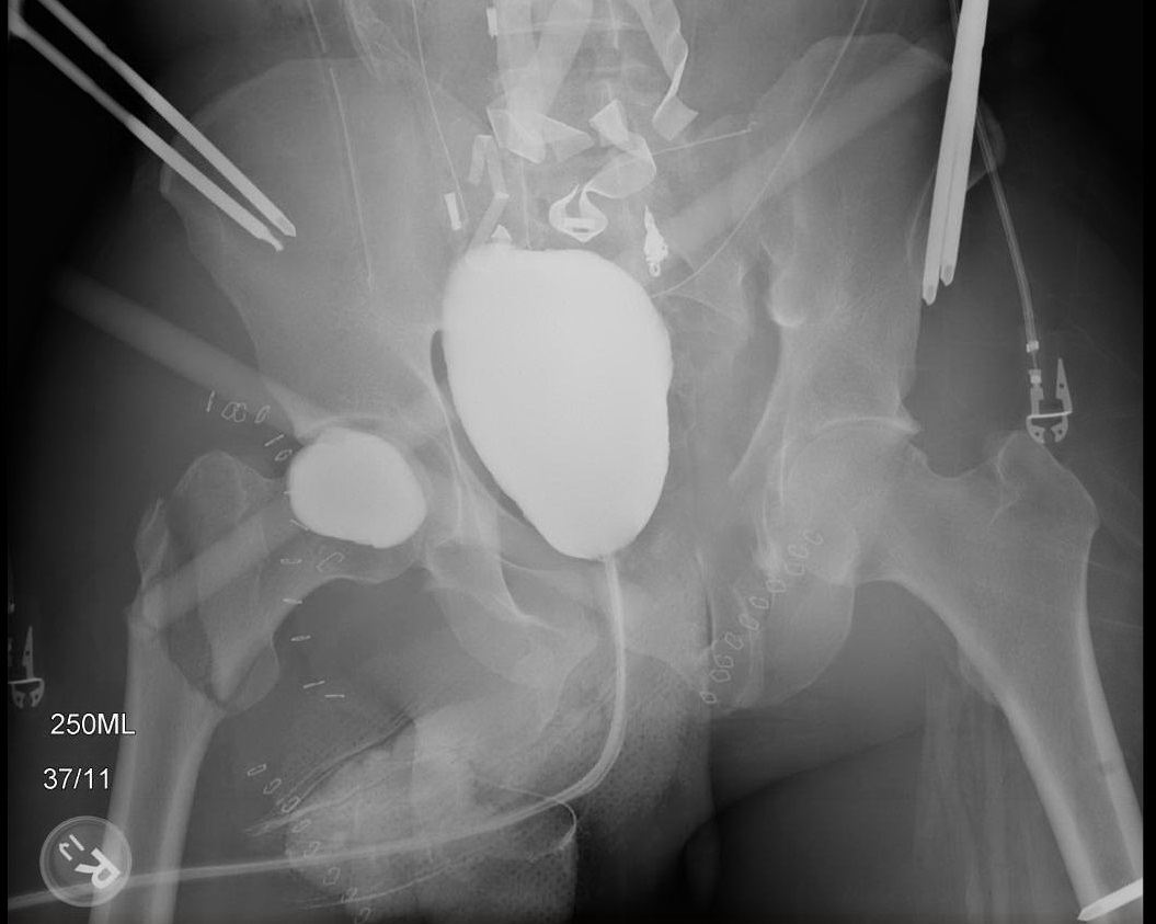 Cystogram